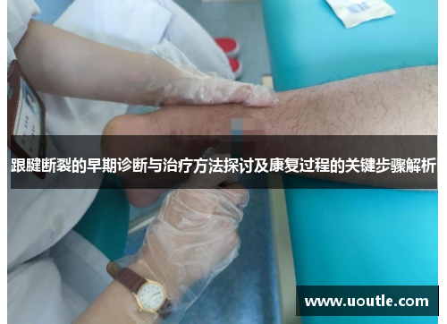 跟腱断裂的早期诊断与治疗方法探讨及康复过程的关键步骤解析